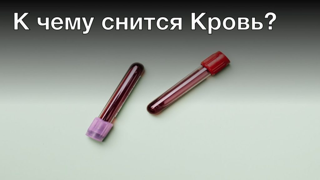 К Чему Снится Кровь: значения и толкования сновидений